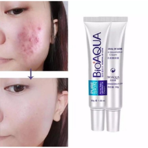 Bioaqua Acne Cream in Pakistan