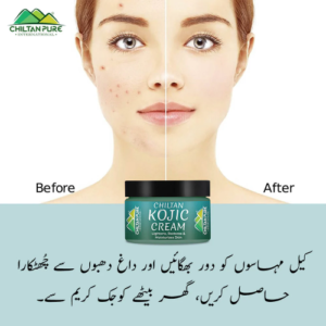  Kojic Cream Affordable and quality body cream