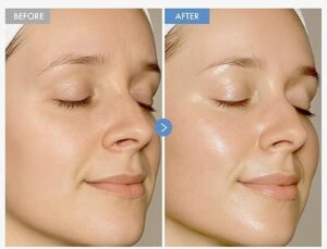 TOSOWOONG Hyaluronic Acid 9 Cream